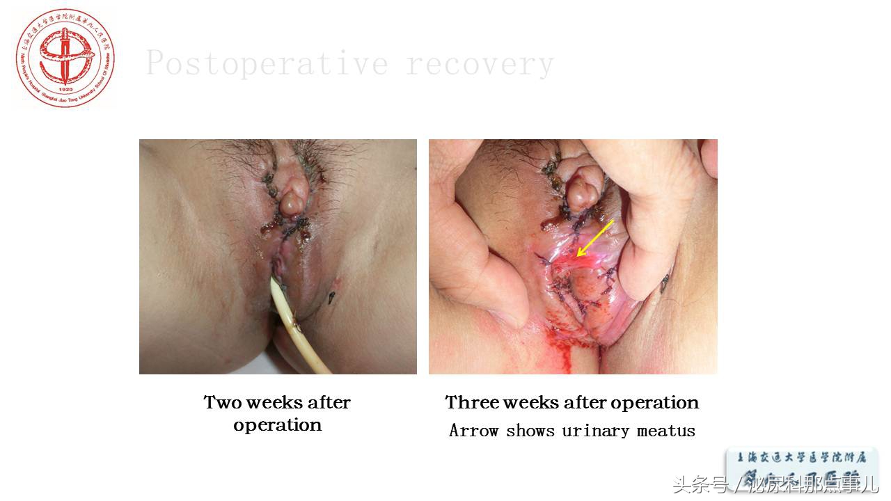 泌尿男科王忠教授,泌尿外科专家王忠教授