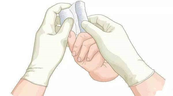 术后刀口露钢板不愈合中医疗法,术后伤口有个小洞一直不愈合