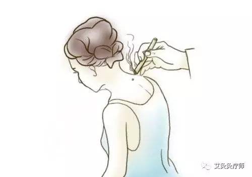 艾灸经络塑形,艾灸哪个穴位可以减内脏脂肪