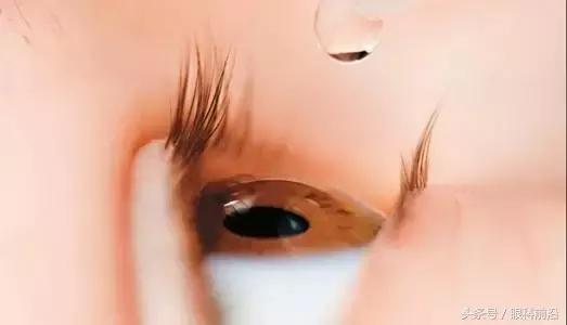 眼药水直接滴眼球上毁眼睛,眼药水为什么不能滴在黑眼球上