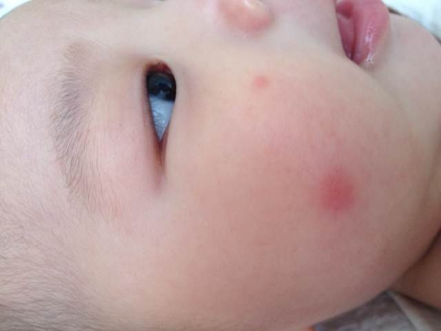 妙招解决身体大毛病