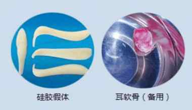 耳软骨垫鼻尖后期会塌吗,耳软骨垫鼻尖后期会下垂吗