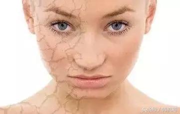 脸上起皮发痒擦睡眠面膜能改善吗,皮肤过敏可以擦洋甘菊睡眠面膜吗