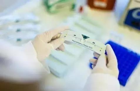 血小板减少性紫癜是大病吗好治吗,血小板减少紫癜是什么病能治好吗