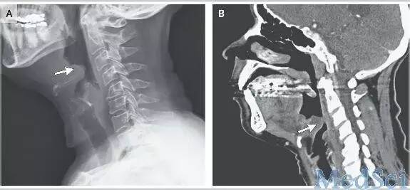 提醒不要疏忽大意的警示语,提醒不要疏忽大意的古句
