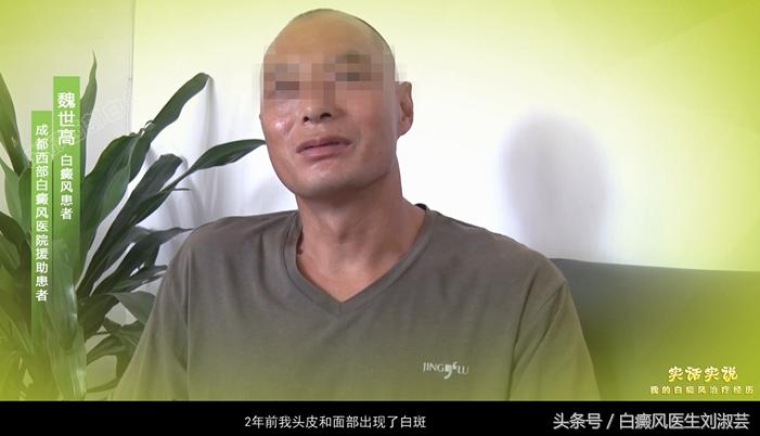 得了白质病要怎么治疗,患白
