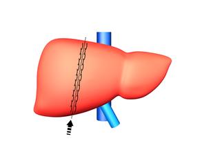 大三阳禁忌食物一览表,大三阳和小三阳区别