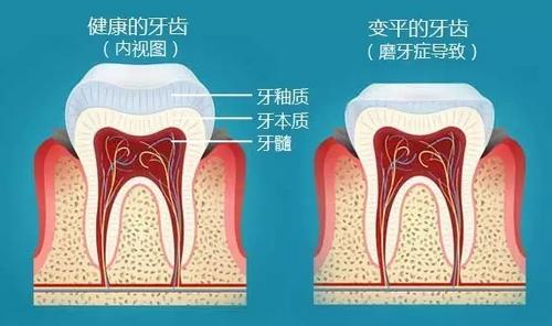 夜里磨牙咬牙怎么治疗,咬牙切齿的磨牙声