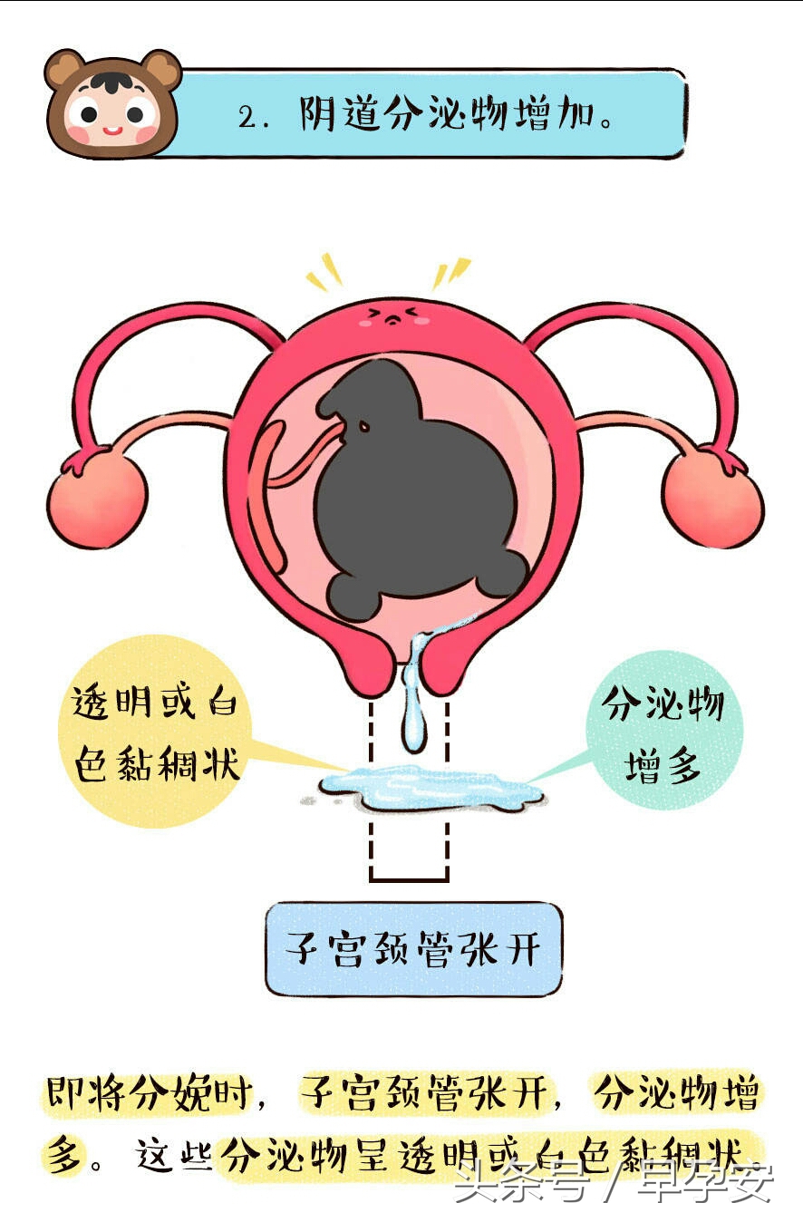 二胎见红宫缩不规律腰酸,临产是先有宫缩还是先见红
