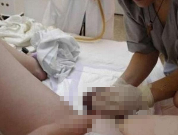 顺产宝宝为什么知道往外钻,生孩子的时候胎儿会自己往外钻吗