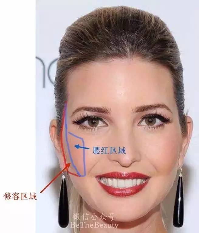 鎬庝箞璁╄劯鍨嬪彉寰楀ソ鐪嬪皬鍦嗚劯,濡備綍璁╄劯鍨嬪彉鎴愭祦鐣呭皬鍦嗚劯