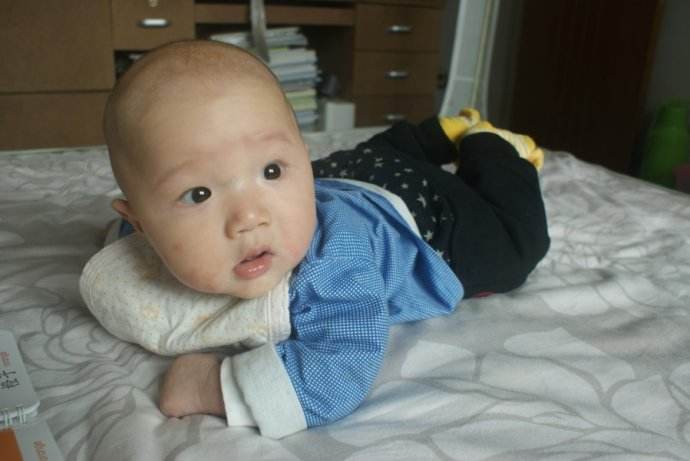 宝宝一急眉毛处就红怎么回事,宝宝眉毛发红是怎么回事