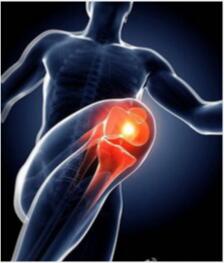 静力蹲保护膝盖吗,膝关节疼痛可以静蹲吗