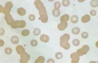 外周血细胞涂片的正常值,外周血细胞分析多长时间出结果