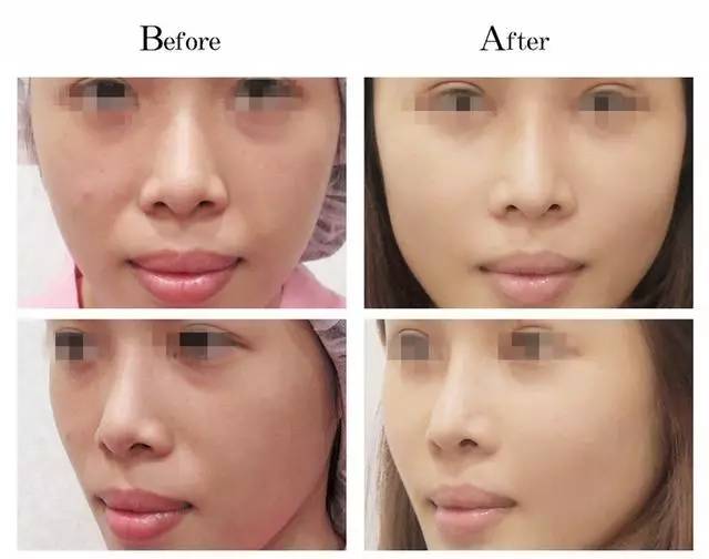 美女与野兽|天生法令纹只能靠整容吗?那是因为你没看这篇!