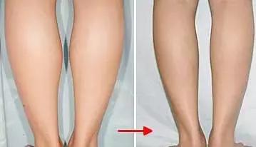 不同腿型适合什么运动,不同类的腿型该怎么瘦腿