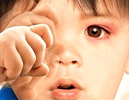 新生儿宝宝眼屎特别多是怎么回事,新生婴儿眼屎多怎么办