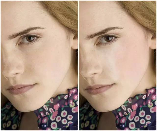 美女与野兽|天生法令纹只能靠整容吗?那是因为你没看这篇!