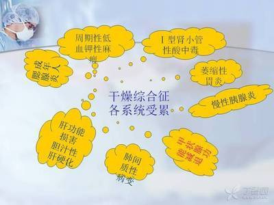 腹泻恶心是肠胃炎吗,急性肠胃炎口干想吐拉肚子