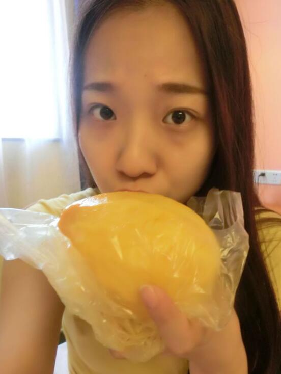 完美的埋线双眼皮,完美双眼皮