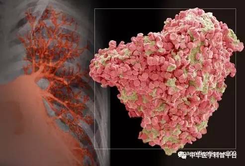 长血栓吃什么药最好,长血栓