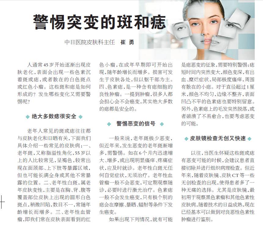中日医院皮肤科,斑点和痣皮肤科看吗