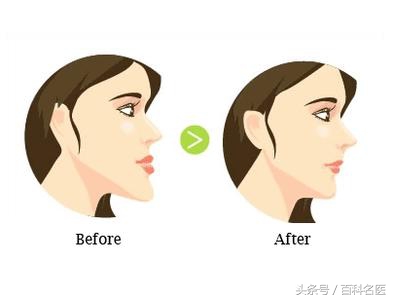 牙齿畸形的六个表现,牙齿畸形矫正图片大全