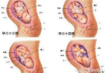 妊娠晚期需要注意什么,卵巢囊肿怀孕晚期要注意哪些问题