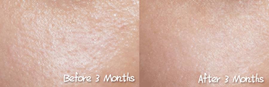 城野医生毛孔收敛水怎么用才有效,城野医生收缩毛孔水正确使用方法