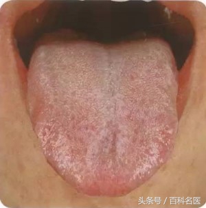 舌头舌诊,如何快速辨舌诊