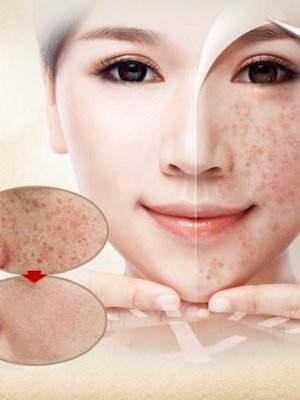 在家怎么自制面膜美白效果好,自己在家做面膜用什么面粉最好