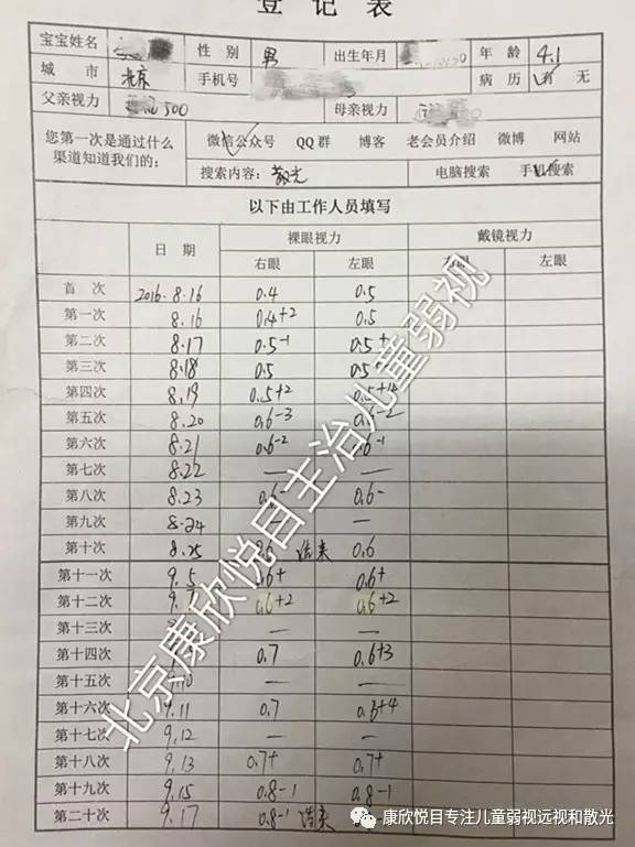 不良的用眼习惯会引发散光