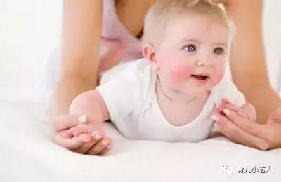 湿疹和痱子如何辨别,湿疹和痱子怎么分辨