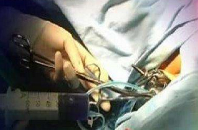 检查输卵管疼不疼,输卵管造影检查疼不疼要做多久