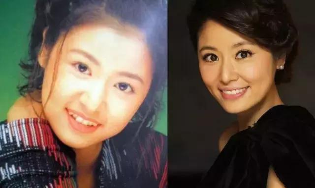 有多少明星整了鼻子,整过的明星有哪些