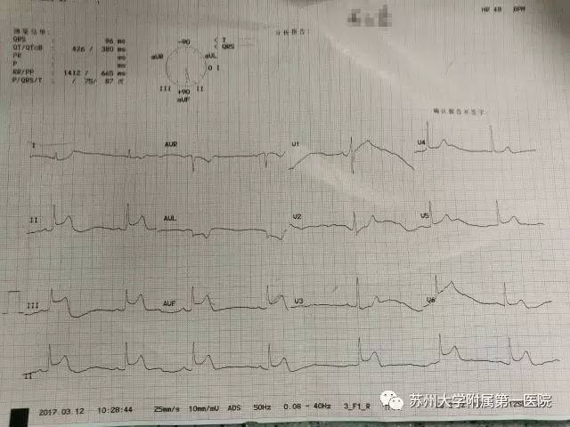 你以为只是一过性眼前发黑？这黑朦，一不小心蒙你没商量！