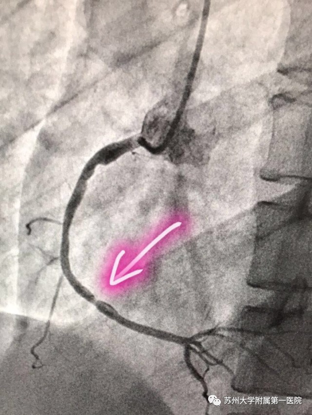 你以为只是一过性眼前发黑？这黑朦，一不小心蒙你没商量！