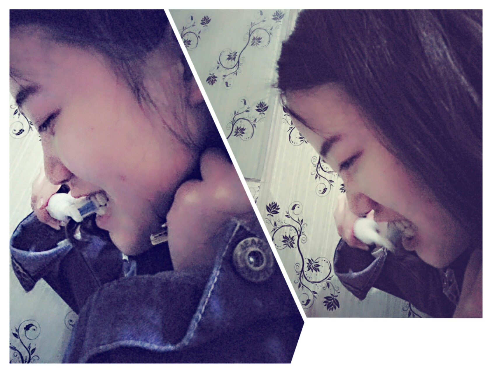 矫正牙齿用什么软毛电动牙刷好,哪一款电动牙刷对牙齿好