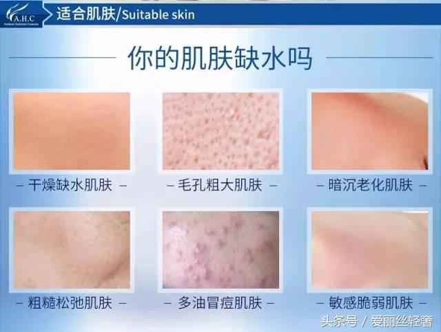 ahc玻尿酸补水保湿神仙水,补水保湿ahc测评