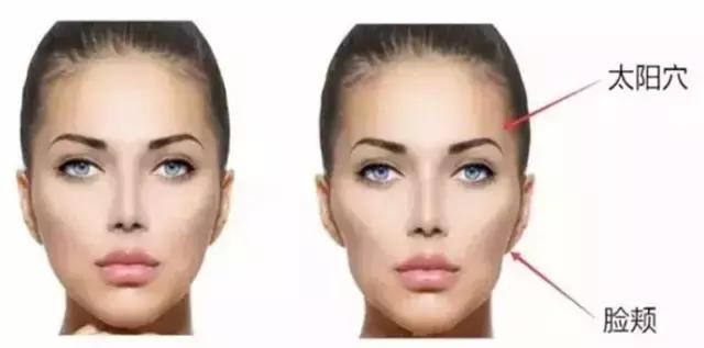 牙套脸怎么矫正最有效,牙套脸怎么防止掉