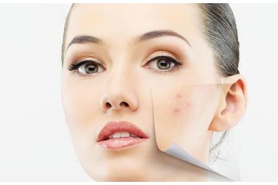 去痘印最有效简单的方法,祛痘印最简单有效的方法