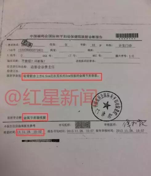 红星调查,红星调查最新视频