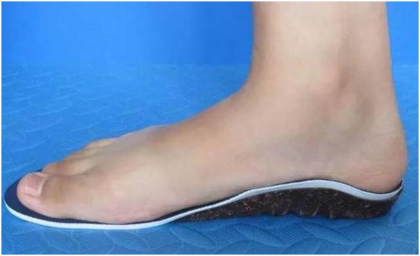 脚外翻可以跑步吗,扁平足