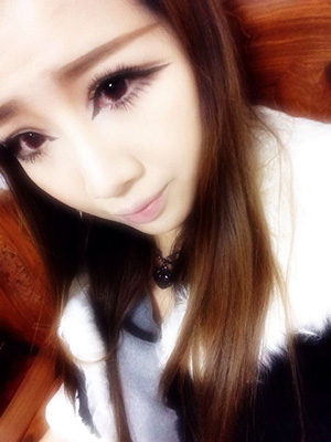 双眼皮手术后修复视频,双眼皮手术恢复记录视频