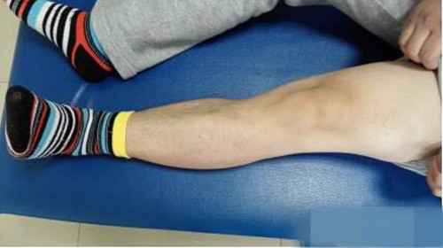 膝关节骨性关节炎的诊断标准,什么是膝关节骨性关节炎阶梯治疗