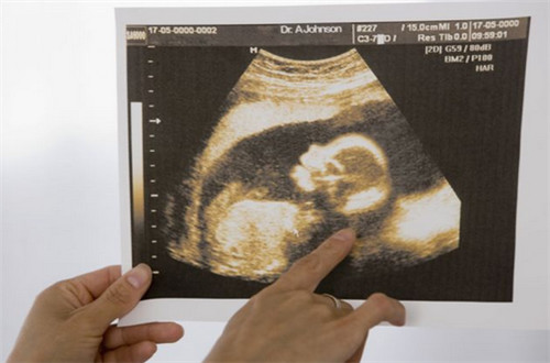 民间偏方治怀不上孩子图文,民间偏方治怀不上孩子