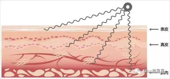 那些坑爹的美妆产品,平价美容仪到底有没有用