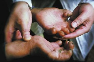 世界十大瘟疫对人类造成的伤害,人类历史上的十大病毒瘟疫