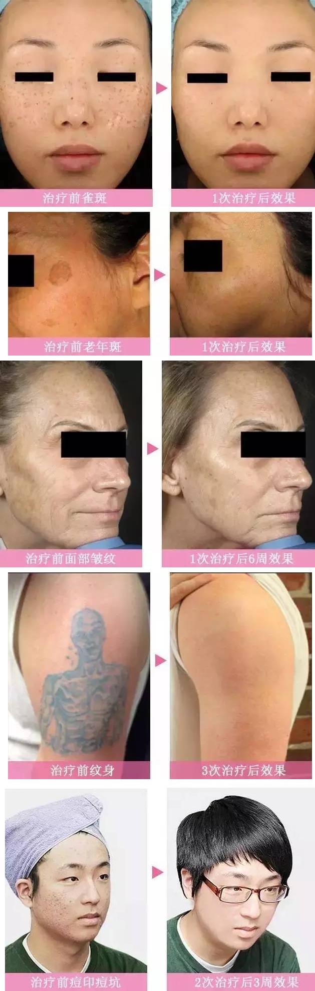 韩辰整形医院武汉光子嫩肤,南京韩辰整形皮肤科电话