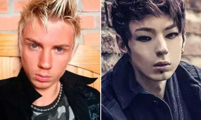 越来越多的男性整形,男士整容变帅案例